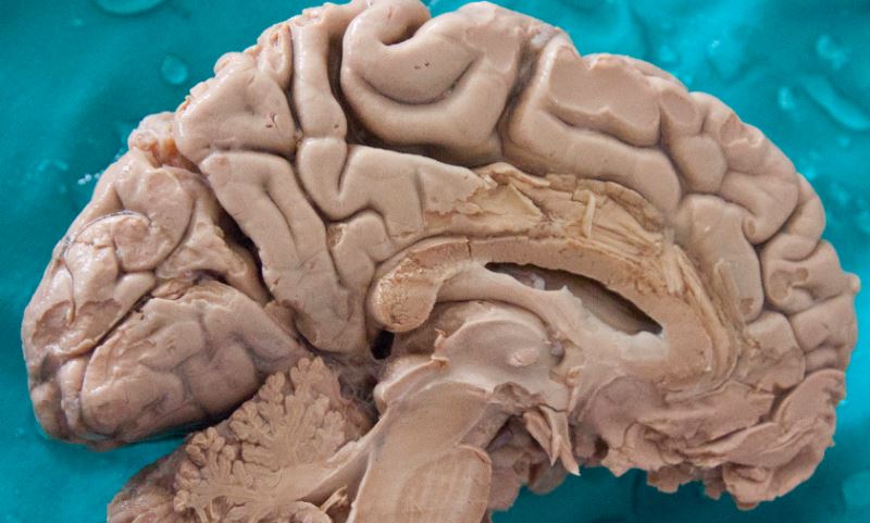 Beýnimiziň diňe 10% -ini ulanyp bilýärismi?