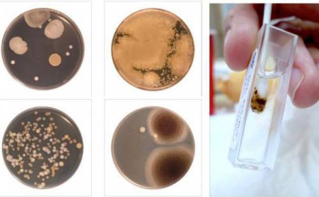 Bedenmiziň Iň Hapa Ýeri