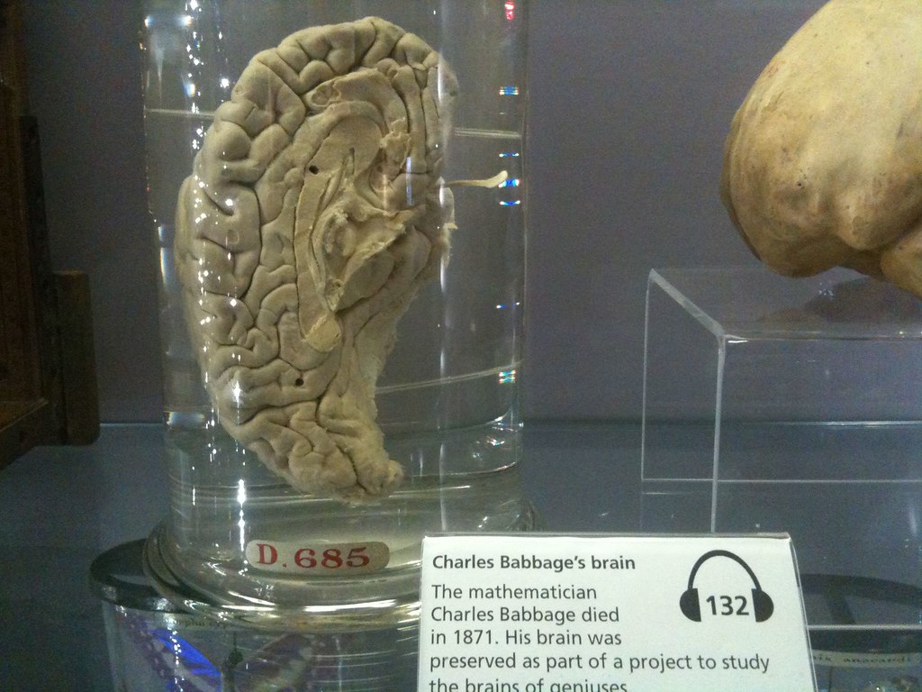 Beden hazyna ýaly saklanylýan